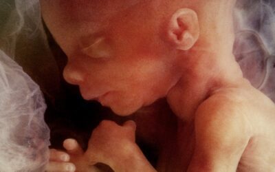 Opinion | Supreme Court Overrules Roe v. Wade in Dobbs Decision – Returns Abortion to State Lawmakers